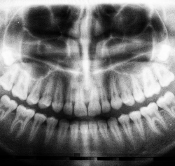  Aspiring Dental Service thumbnail